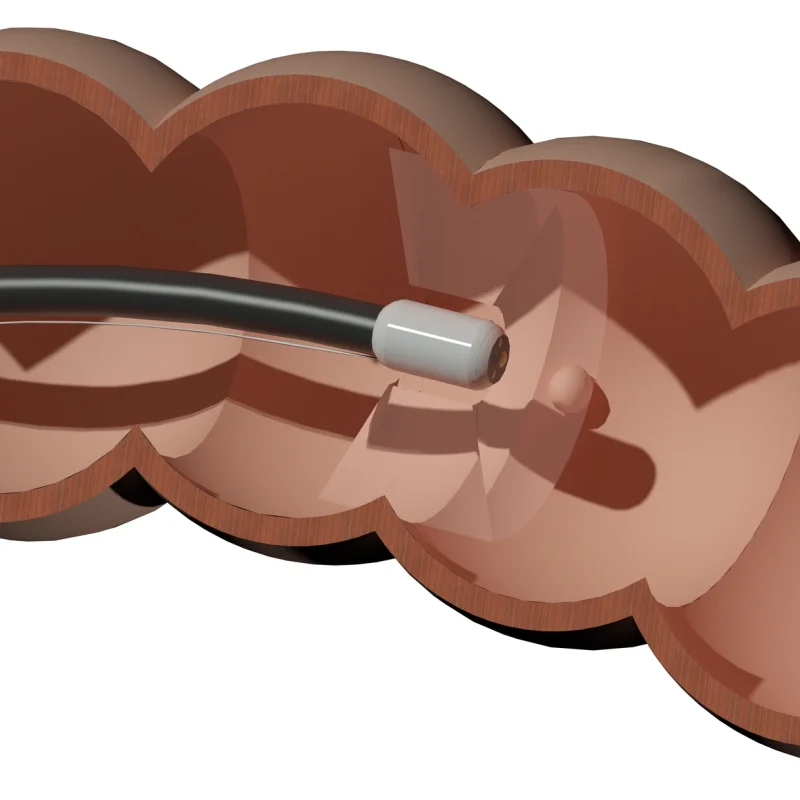 colon_blanc